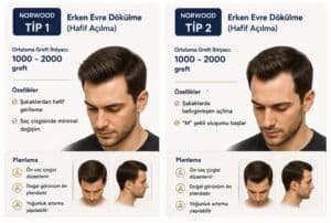 Norwood tipi saç ekimi tip1