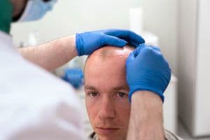 MosHair Clinic Kocaeli saç ekimi operasyonu sırasında uzman doktorun işlem yaptığı hasta yakın plan görseli