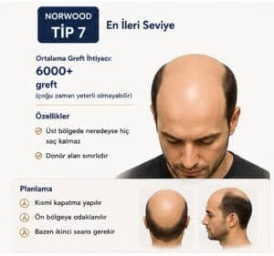 Norwood tipi saç ekimi tip7 en ileri seviye